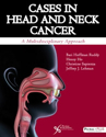 Picture of Cases in Head and Neck Cancer: A Multidisciplinary Approach