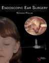 Picture for category Endoscopic Ear Surgery