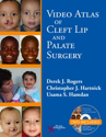 Picture of Video Atlas of Cleft Lip and Palate Surgery