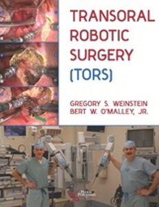 Picture of Transoral Robotic Surgery (TORS)