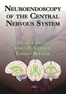 Picture of Neuroendoscopy of the Central Nervous System
