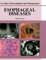 Picture of Esophageal Diseases: An Atlas of Investigation and Management
