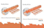 Picture of Vocabulary Building Exercises for the Young Adult — Complete Kit